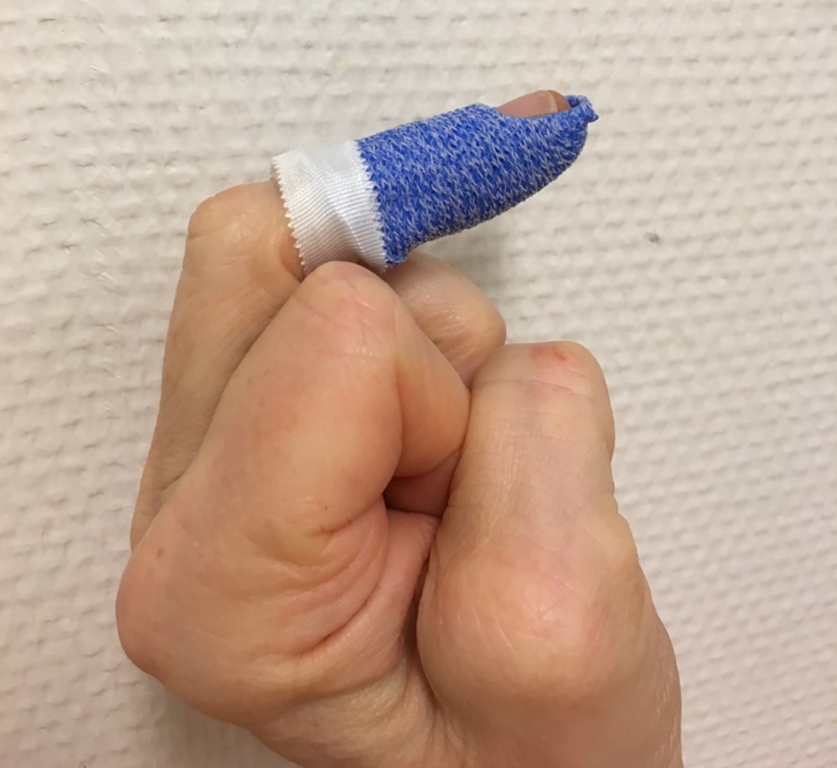Polstret aluminiumsskinne over DIP-leddet